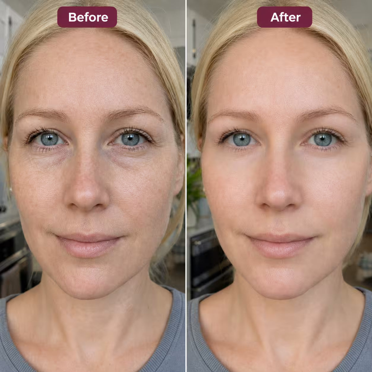 Omi Mei Peptide Collagen Eye Patches